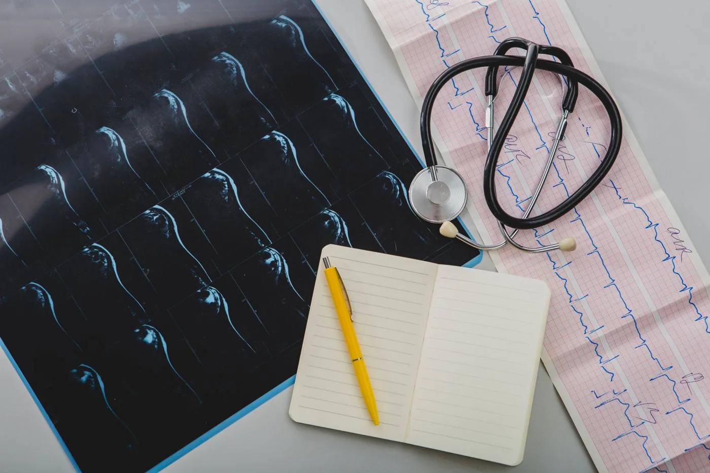 Heart scan images, ECG strip and stethoscope
